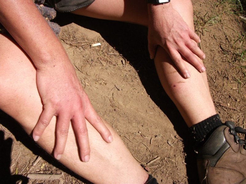 m-swollen-hands-and-leg
