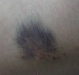 16-bruise-and-scars-from-the-descent